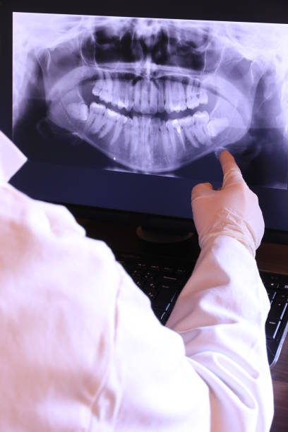 Best Emergency Treatment for Toothache in Canton, PA