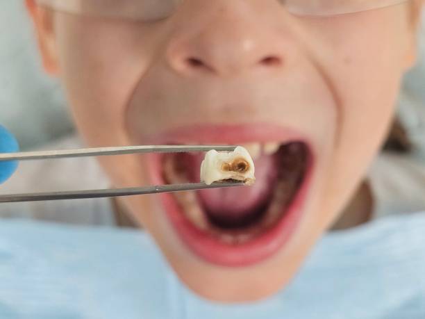 Best Emergency Broken Tooth Repair in Canton, PA